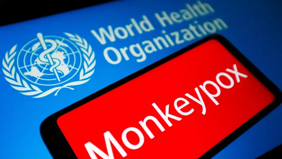 All you need to know about Monkeypox Virus