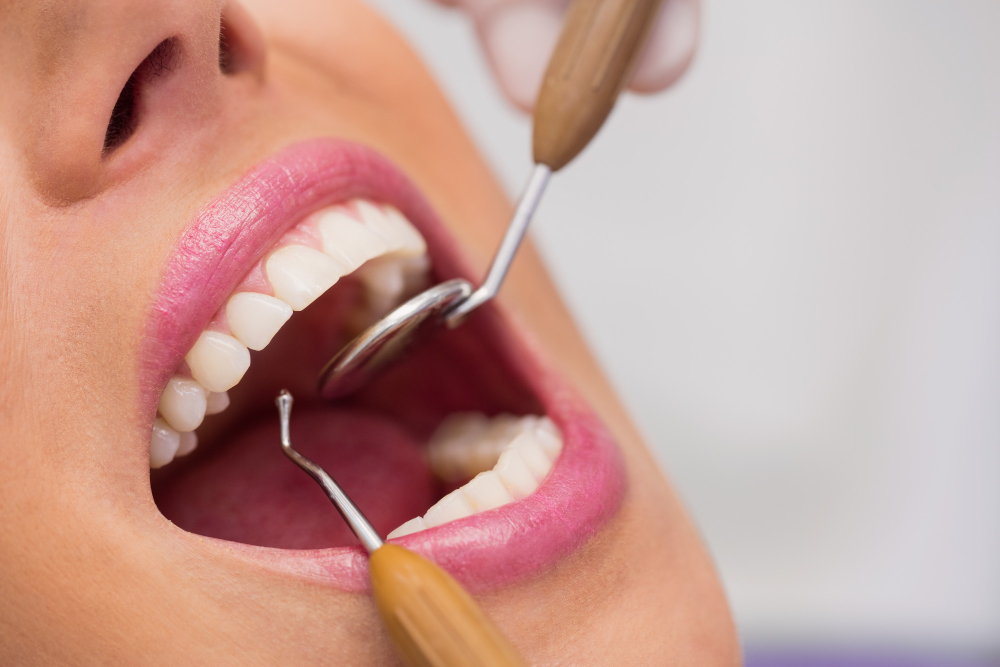 Dental