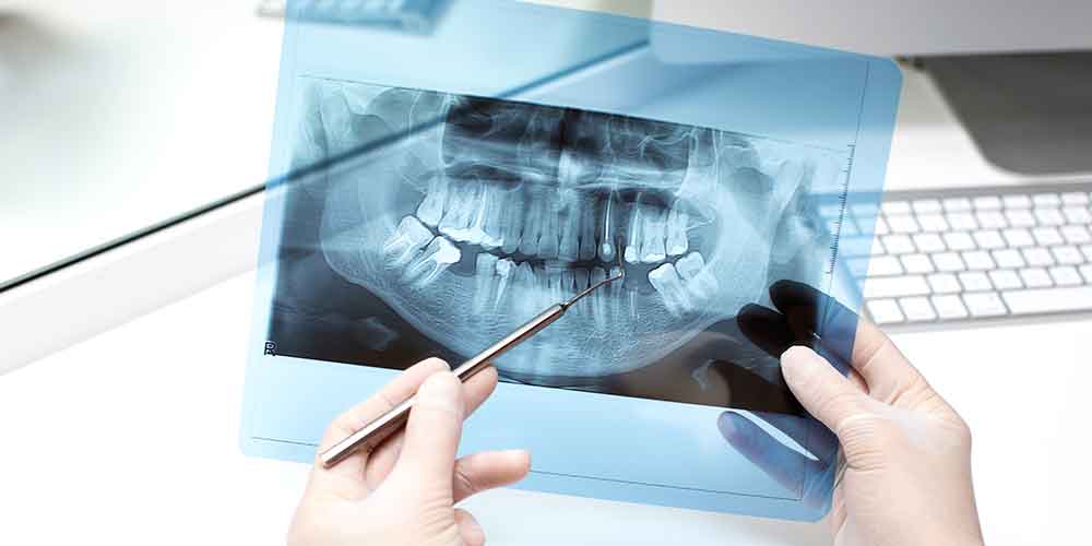 Unraveling the Confluence of Dental and Surgery: A Holistic Insight