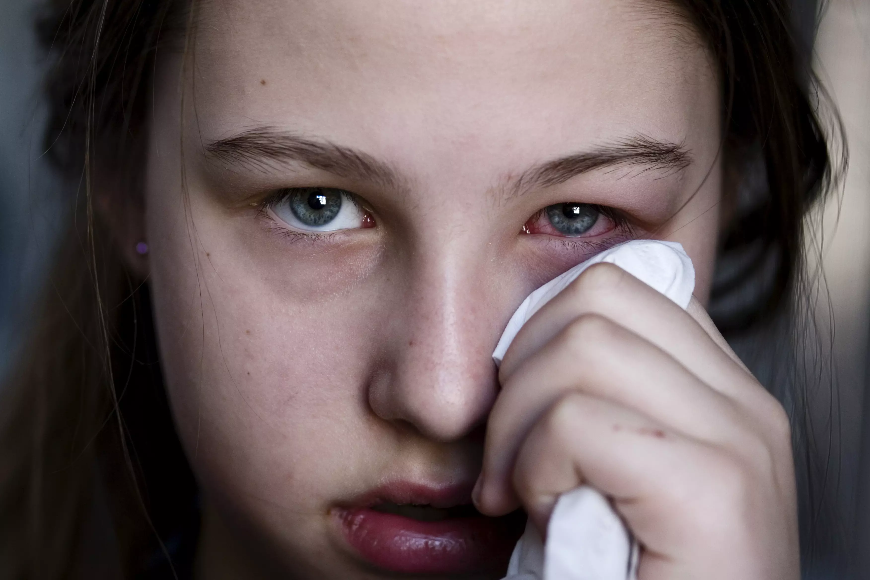 Что вызывает глазное кровотечение и как оно проходит?