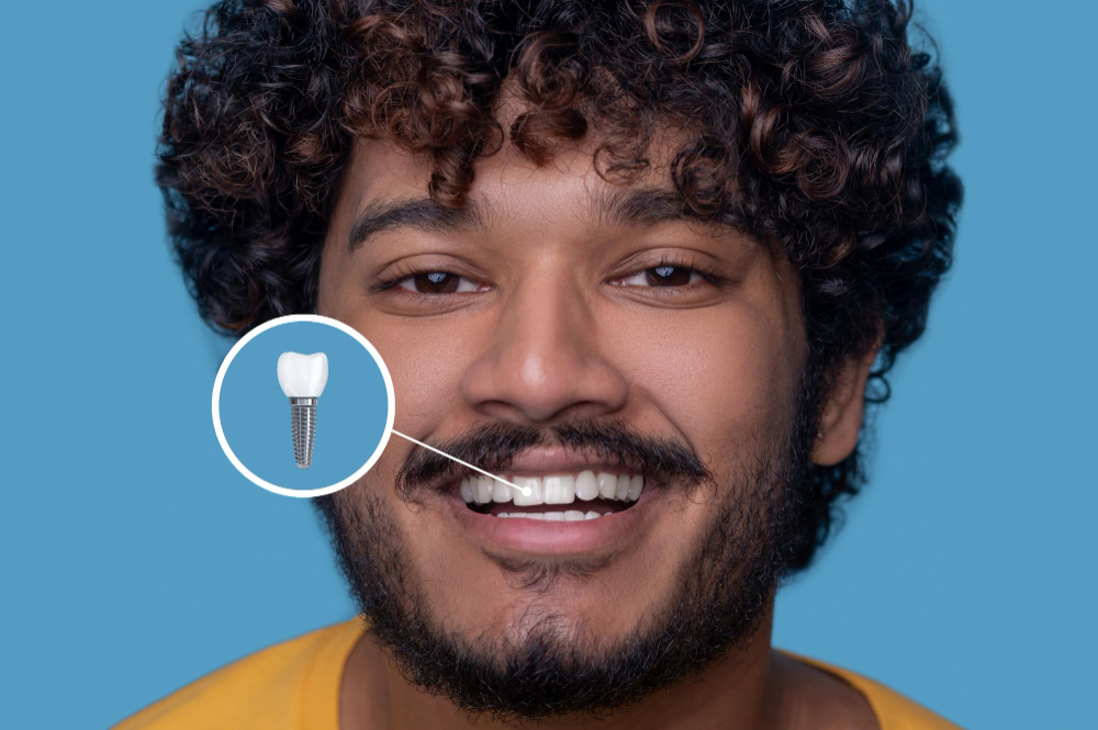 What Is a Dental Implant?