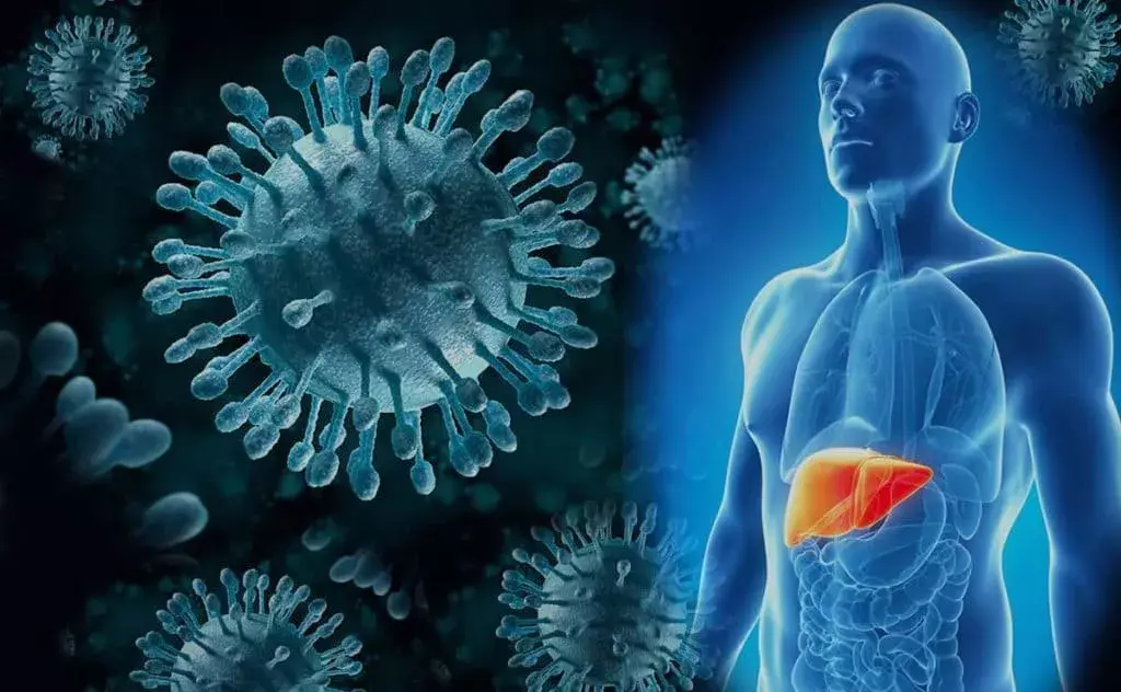 What Is Viral Hepatitis?