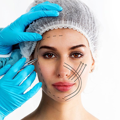Face Lift (Rhytidectomy)